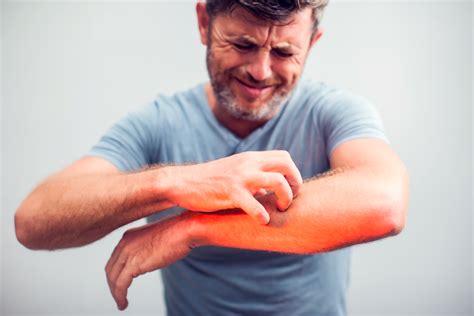 Itchy o - Common causes include: dyes in clothes. beauty products. poisonous plants, such as poison ivy and sumac. chemicals, such as latex or rubber. A food allergy can also cause a rash and other symptoms ...